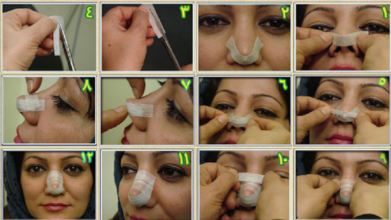 نحوه صحیح چسب زدن بینی