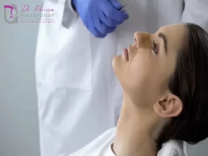 ورزش بعد از جراحی بینی