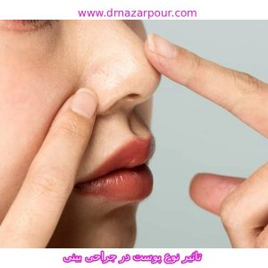 تاثیر نوع پوست در جراحی بینی