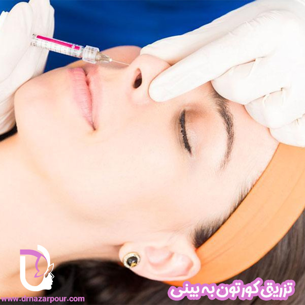 تزریق کورتون به بینی 