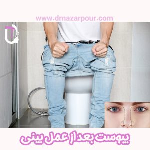 یبوست بعد از عمل بینی