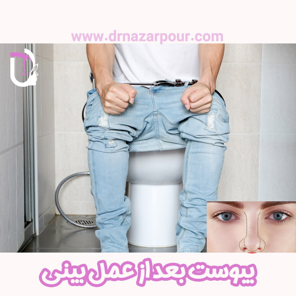یبوست بعد از عمل بینی 
