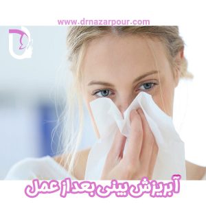 آبریزش بینی بعد از عمل