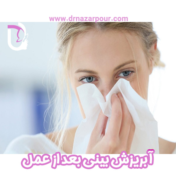 آبریزش بینی بعد از عمل