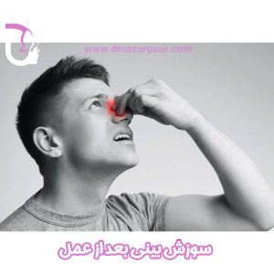 سوزش بینی بعد از عمل