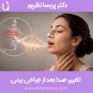 تغییر صدا بعد از جراحی بینی