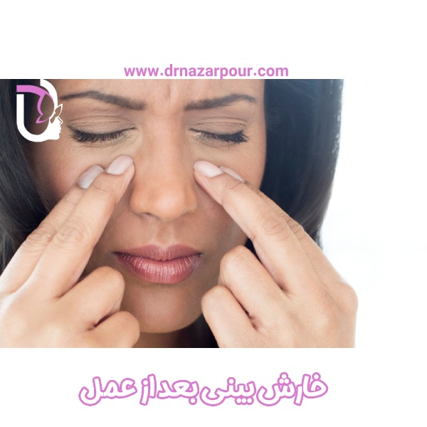 خارش بینی بعد از عمل