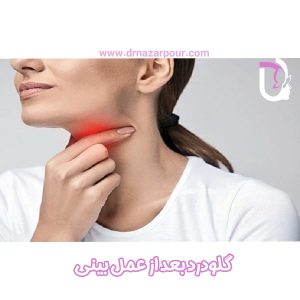 گلودرد بعد از عمل بینی