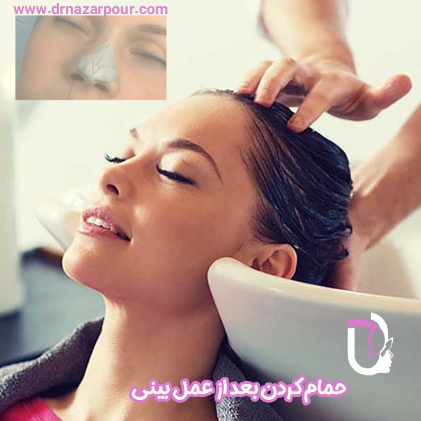 حمام کردن بعد از عمل بینی