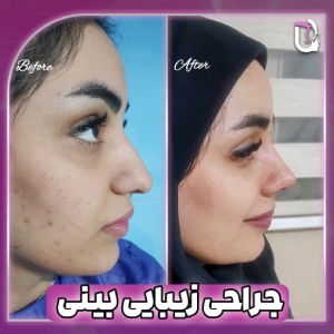 نمونه کار دکتر پریسانظرپور 