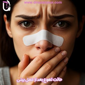 حالت تهوع بعد از عمل بینی