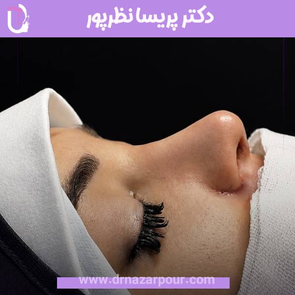 جراحی بینی استخوانی