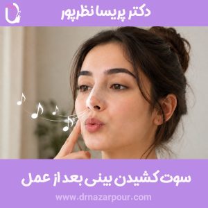 سوت کشیدن بینی بعد از عمل