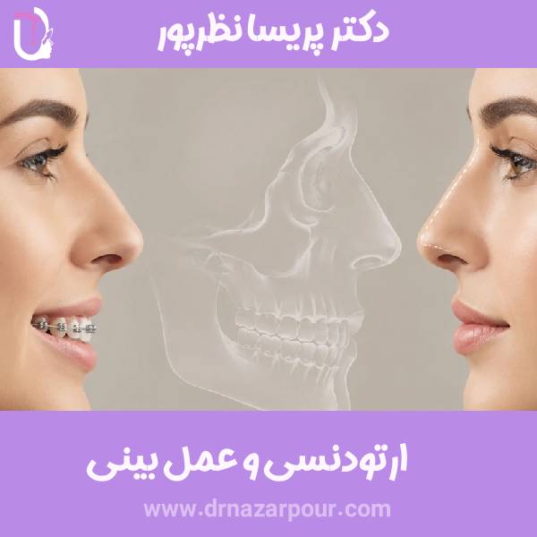 ارتودنسی و جراحی بینی