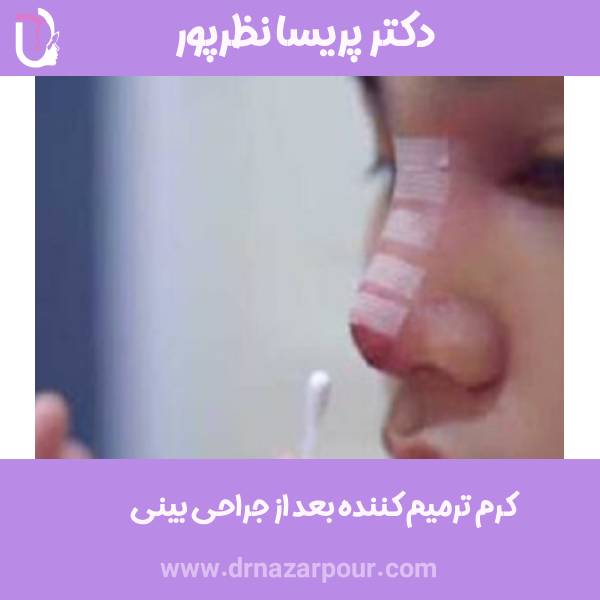 کرم ترمیم کننده بعد از جراحی بینی