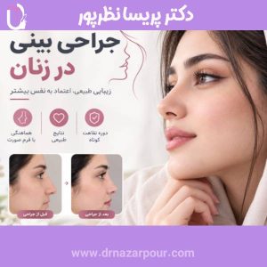 عمل بینی دخترانه و شیک