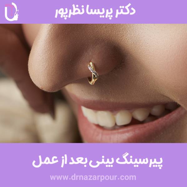 پیرسینگ بینی بعد از جراحی