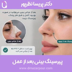 پیرسینگ بینی بعد از جراحی