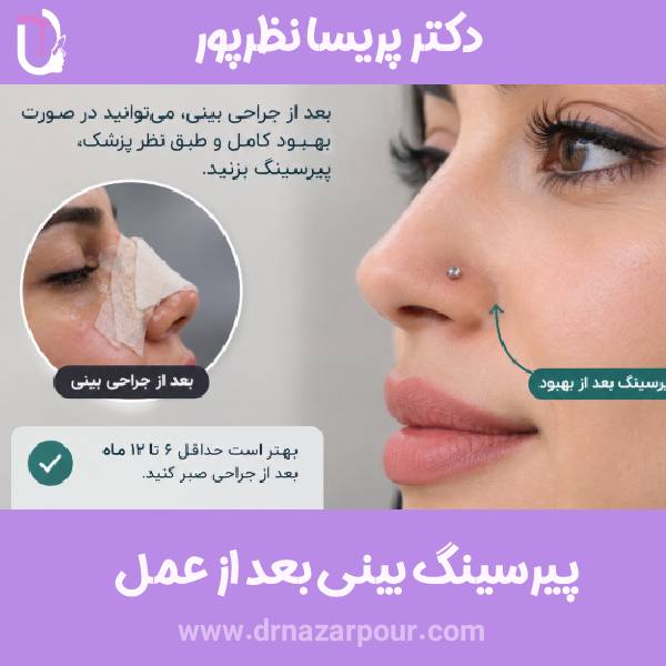پیرسینگ بینی بعد از جراحی
