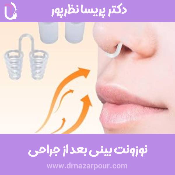 نوزونت بینی
