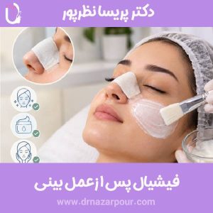 فیشیال بعد از جراحی بینی