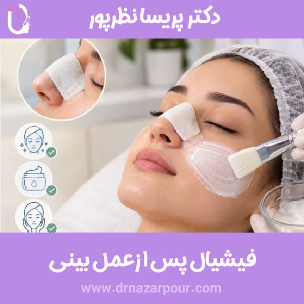 فیشیال بعد از جراحی بینی