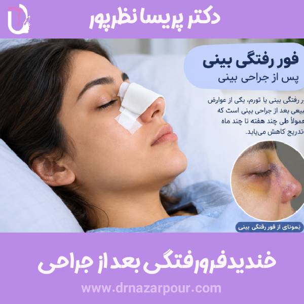فرو رفتگی بینی پس از جراحی